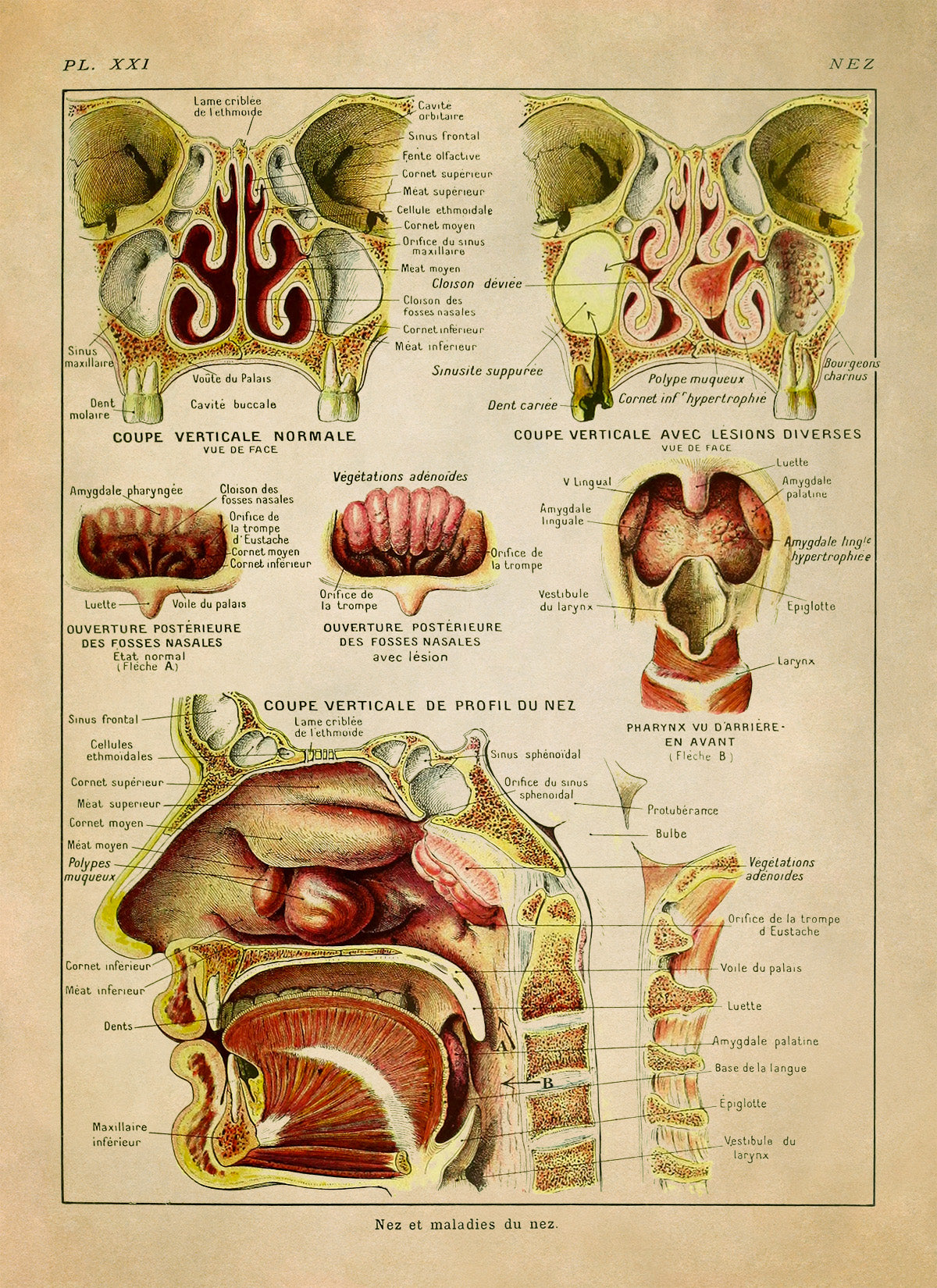 Human Nose and Throat Medical Anatomy Chart Print, AM88