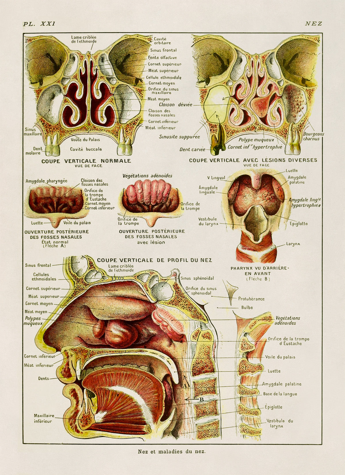 Human Nose and Throat Medical Anatomy Chart Print, AM88