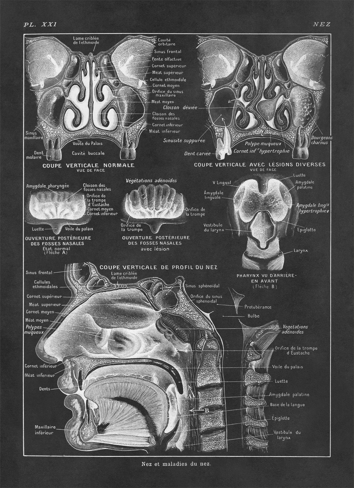 Human Nose and Throat Medical Anatomy Chart Print, AM88