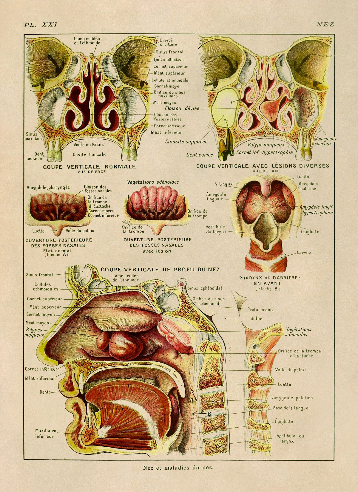 Human Nose and Throat Medical Anatomy Chart Print, AM88