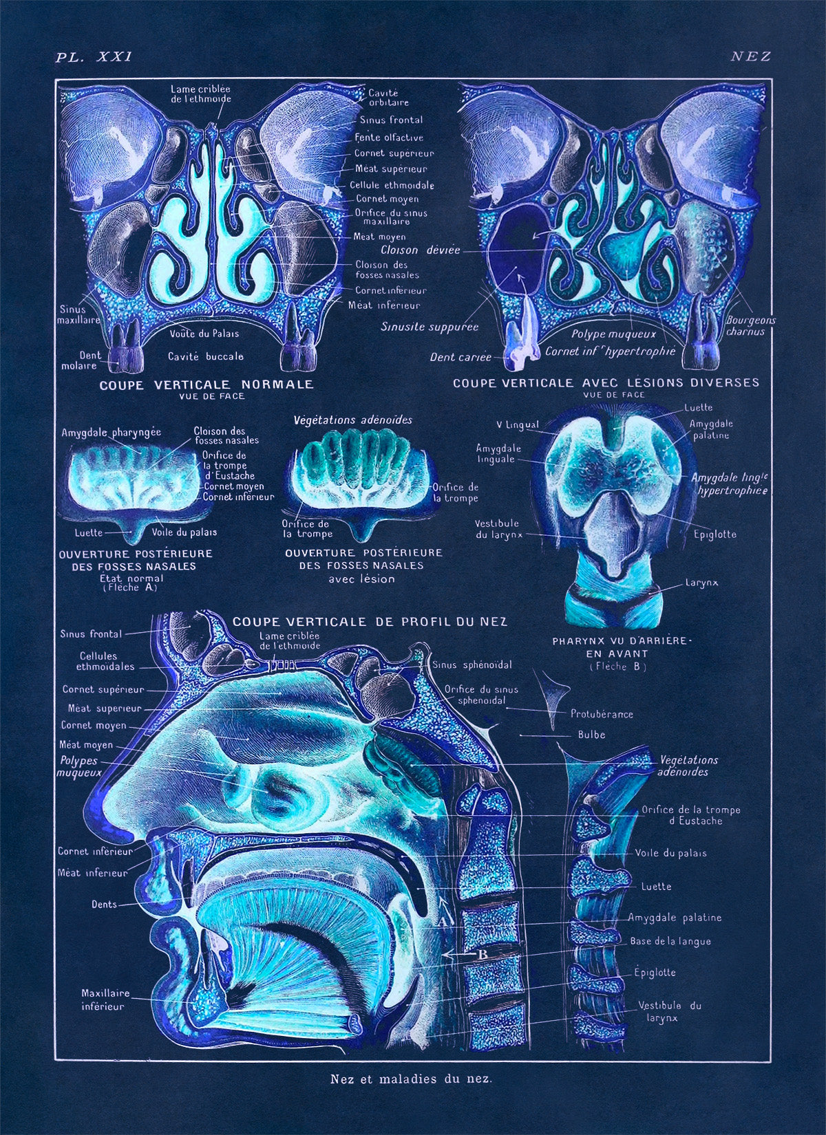 Human Nose and Throat Medical Anatomy Chart Print, AM88